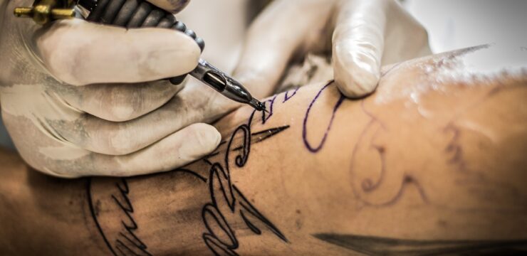 laser-tattoo-removal
